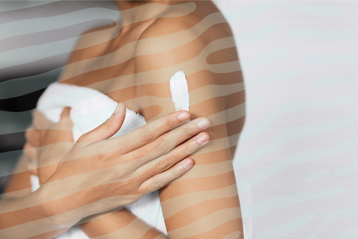 The Best Cream for Eczema